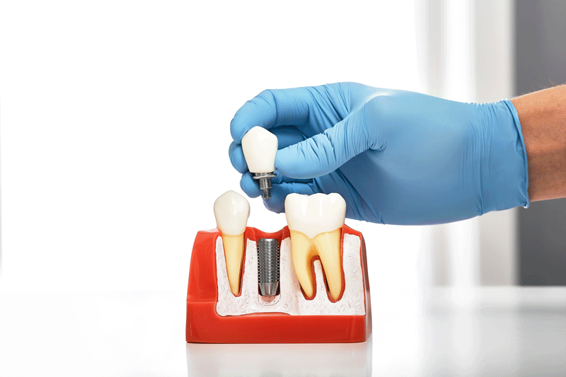 Will I Be Able To Get A Wisdom Tooth Removal In Coventry, RI?