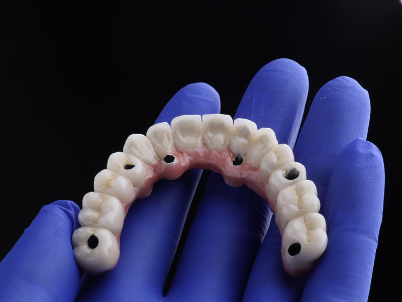 Navigating the World of Surgery Dental in Coventry, RI